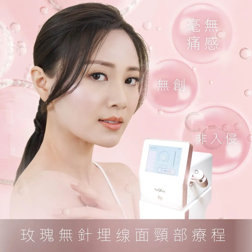 无痛瞬间提拉仿如传统埋线效果