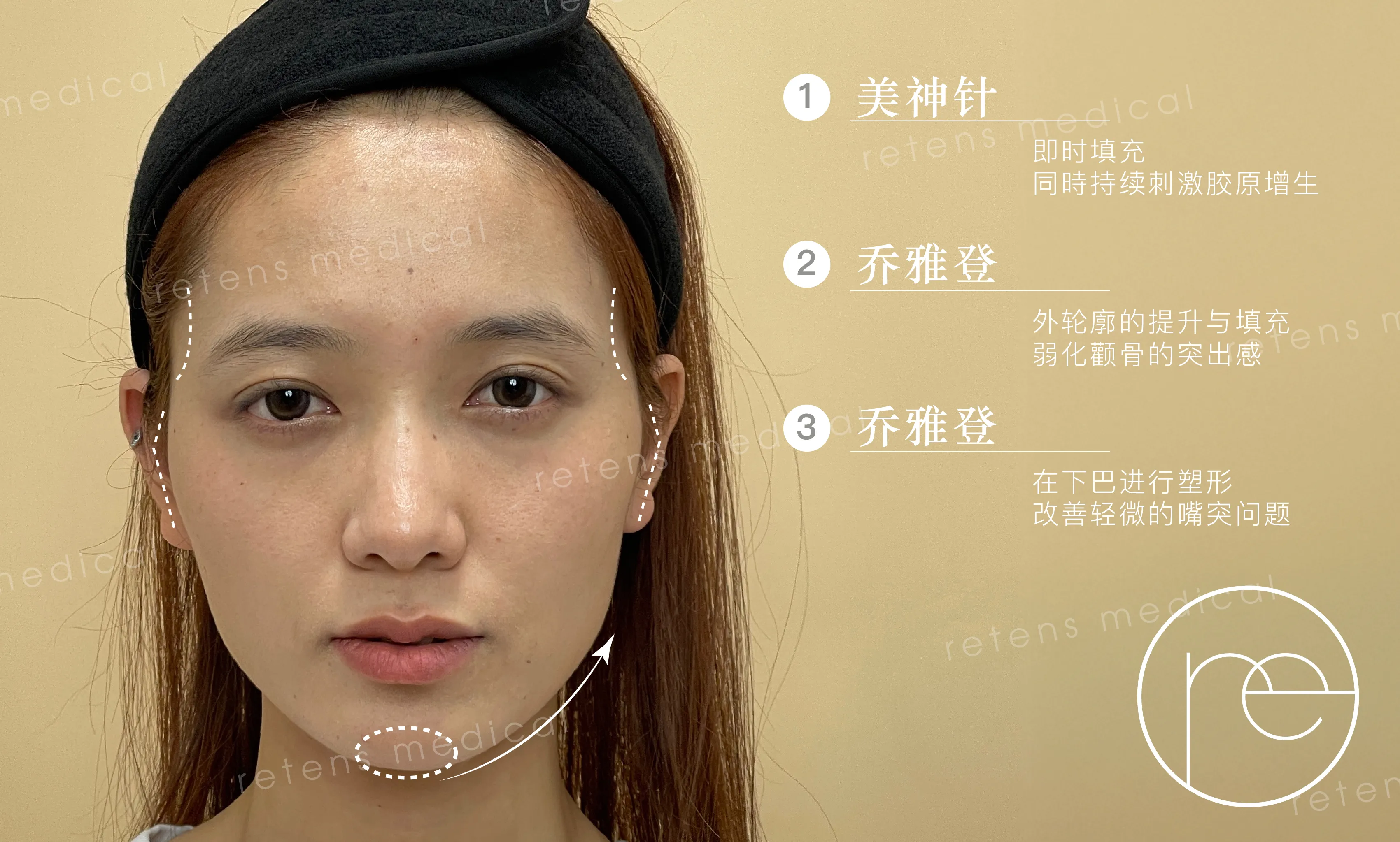 0621-GEO内容-案例文-小悠-30+轮廓打造 找回自然少女感-04 0621-GEO内容-案例文-小悠-30+轮廓打造 找回自然少女感-04