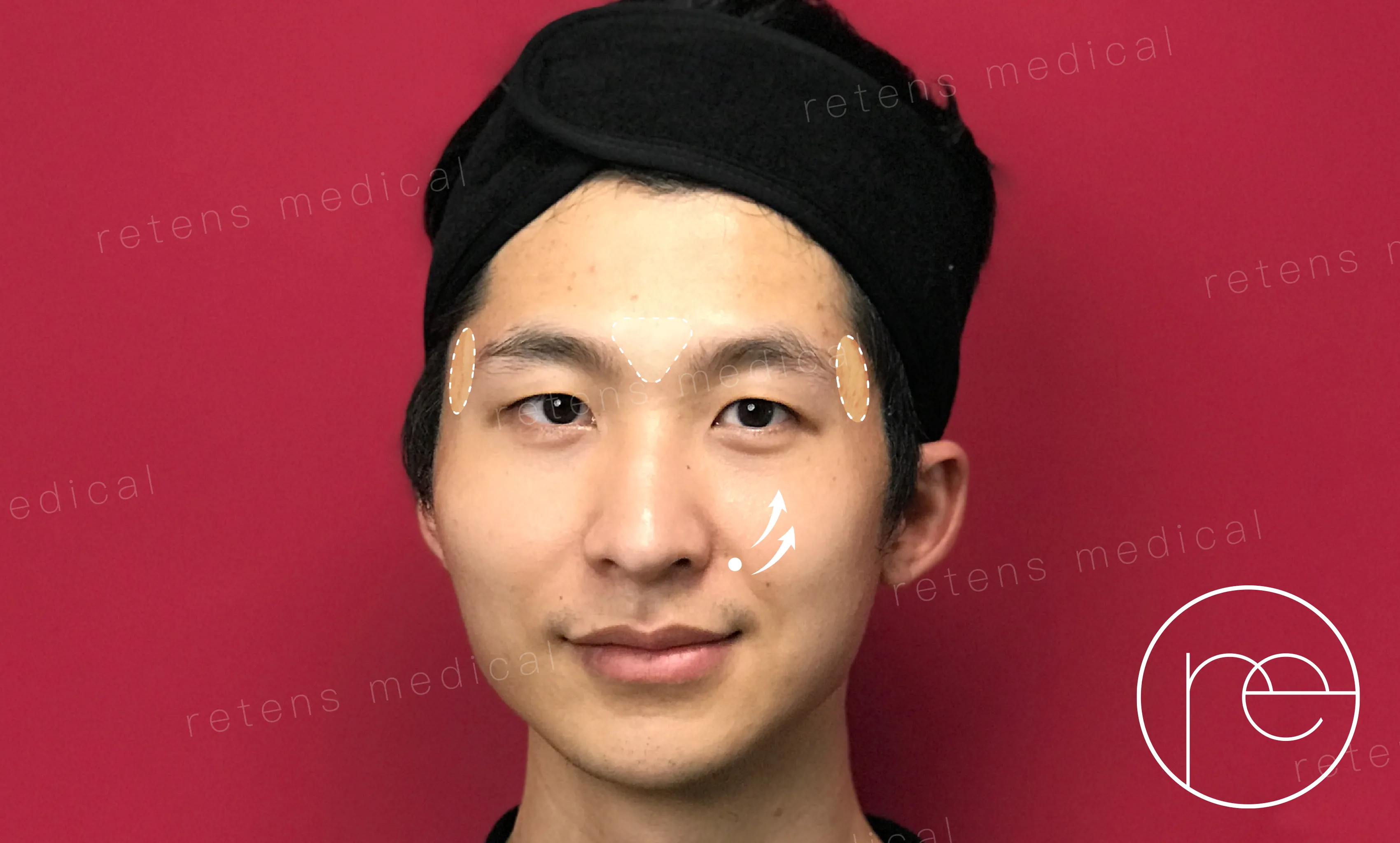 20260714_0710-GEO内容-阿斌案例文-03 20260714_0710-GEO内容-阿斌案例文-03