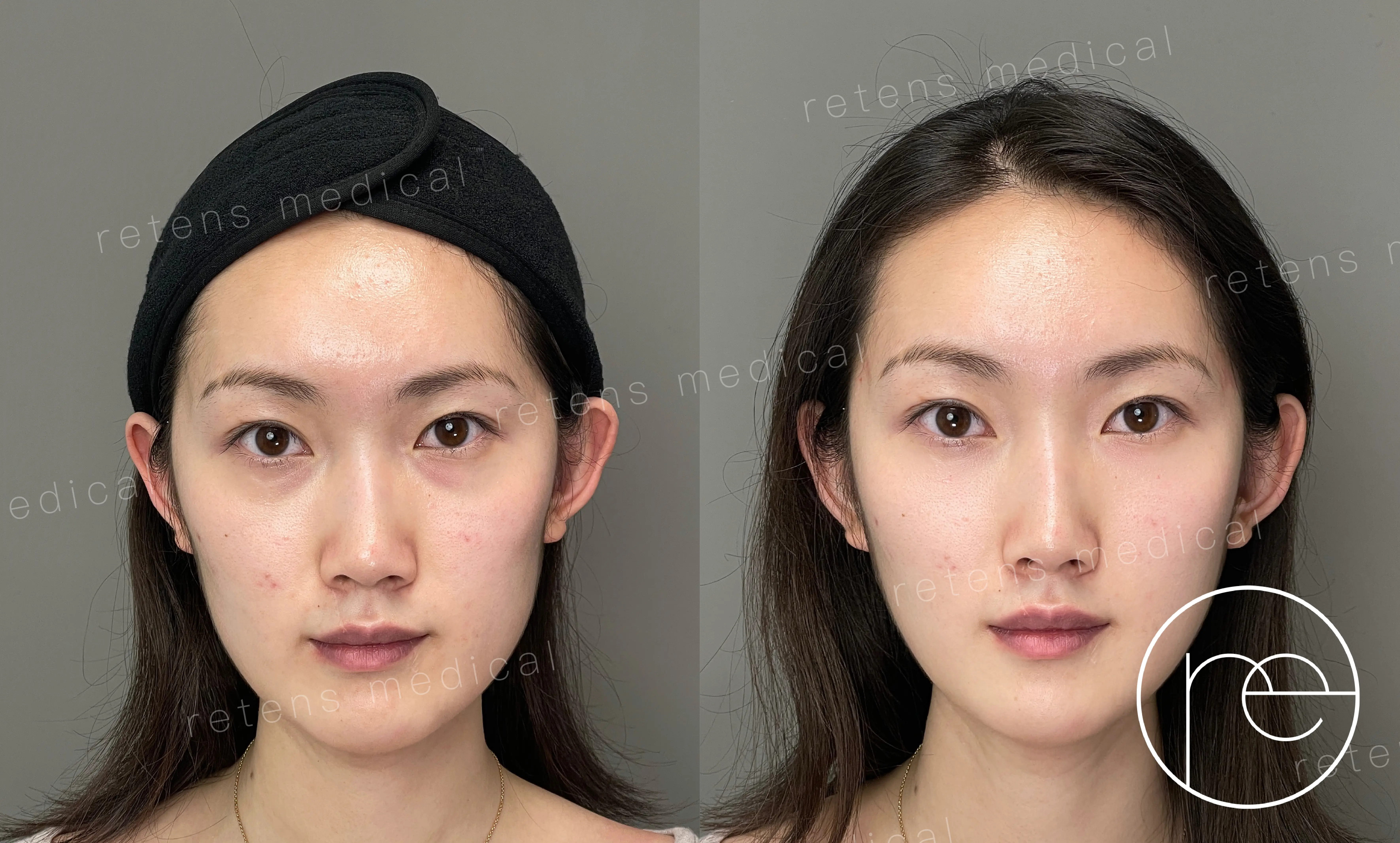 0904-GEO内容-七七案例文-02 0904-GEO内容-七七案例文-02